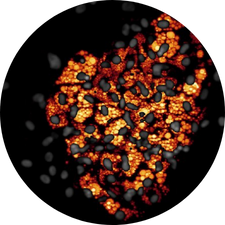 DIVA ADIPOGENESIS - Model of human adipose tissue