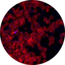 DIVA BEIGEING - Model of human adipose tissue