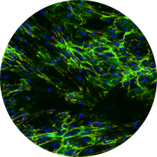 DIVA FIBRO INFLAMM - Model of human adipose tissue