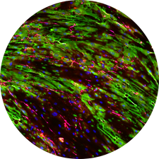 DIVA WOUND HEALING - Model of human adipose tissue